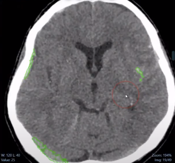 brain_seg