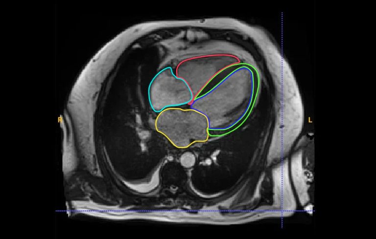 Standardizing Medical Imagery