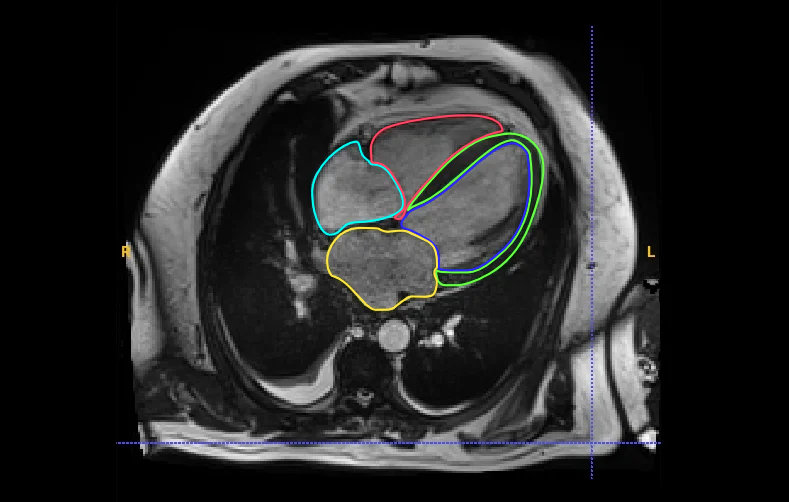 cardiac_seg