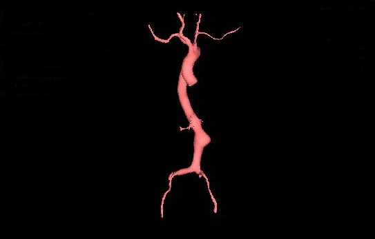 vascular_seg